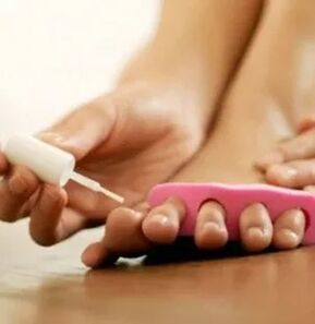 Applicazione della vernice terapeutica